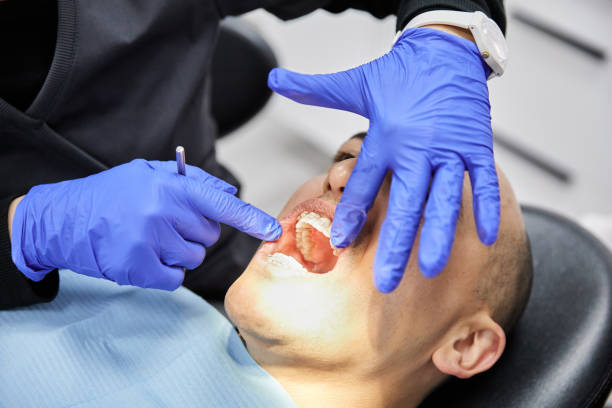 Best Emergency Treatment for Dental Infections or Abscesses in Antelope, CA