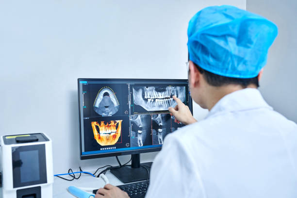 Best Emergency Root Canal Treatment in Antelope, CA